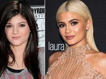 kylie jenner vorher nachher bilder|Die krassesten Beauty